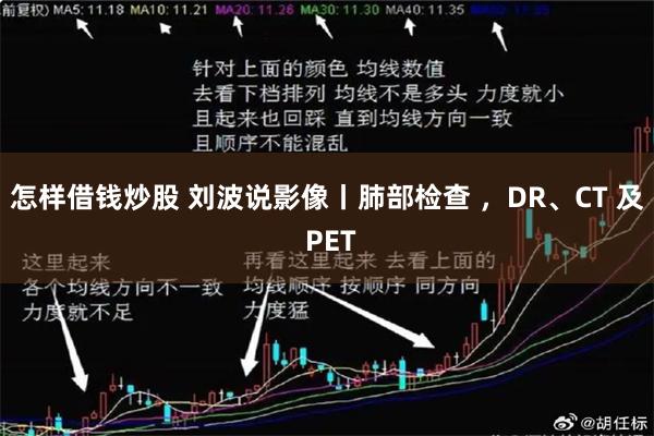 怎样借钱炒股 刘波说影像丨肺部检查 ，DR、CT 及 PET